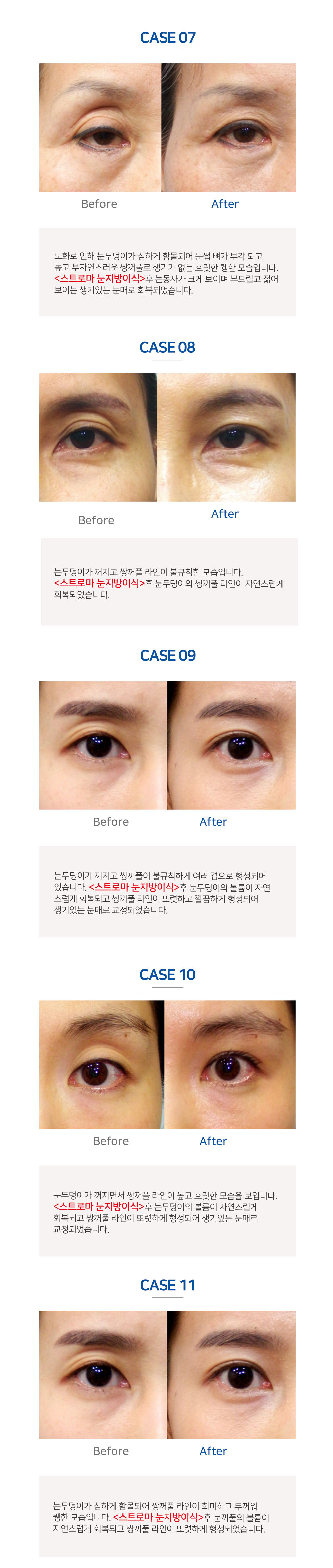 이미지명