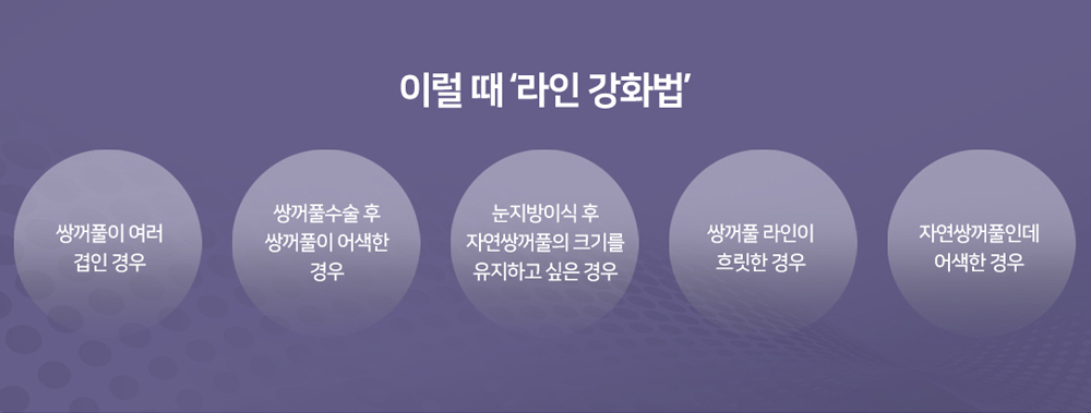 이미지명