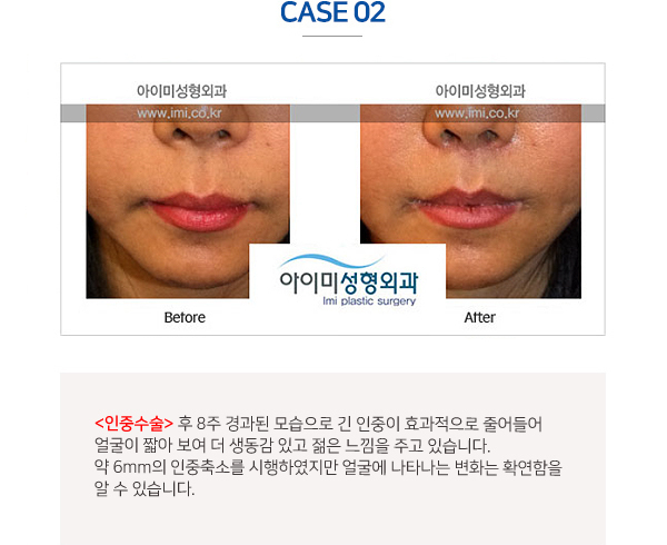 이미지명