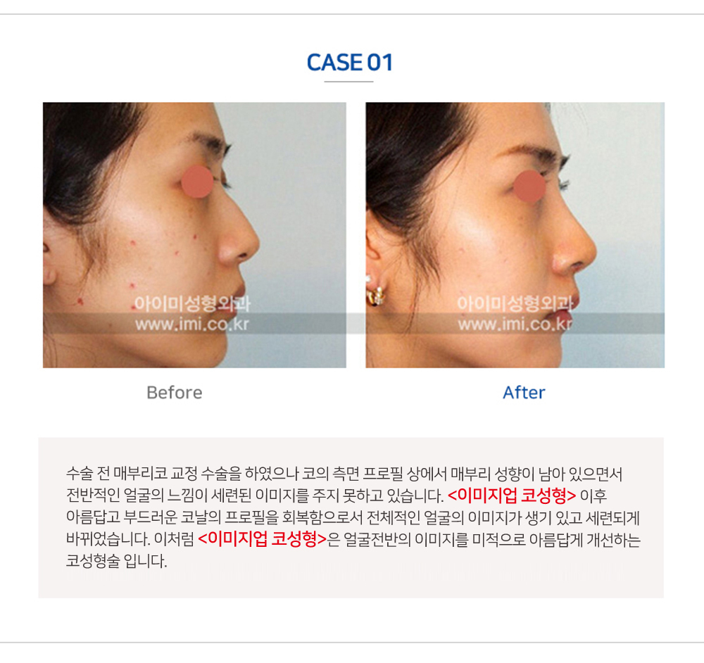 이미지명