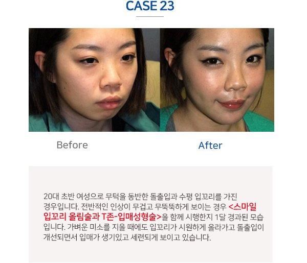 이미지명