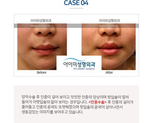 이미지명