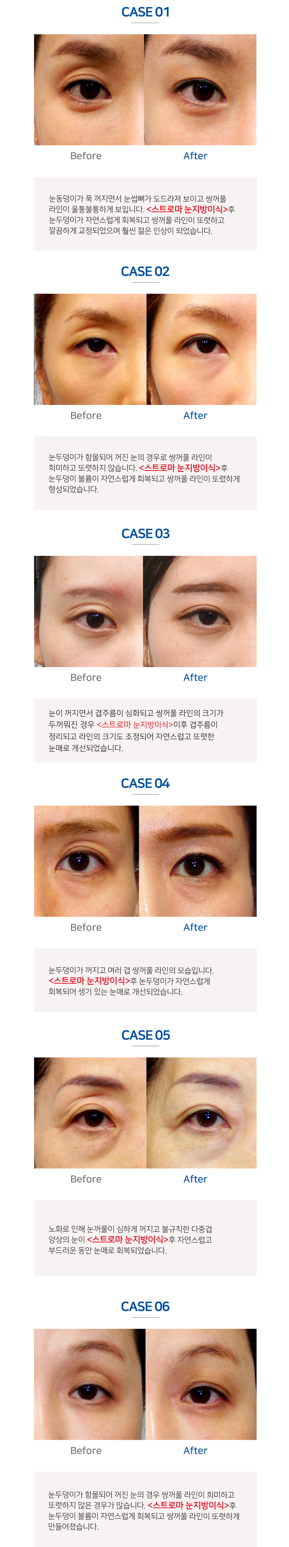 이미지명