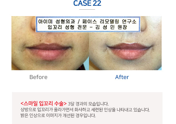 이미지명