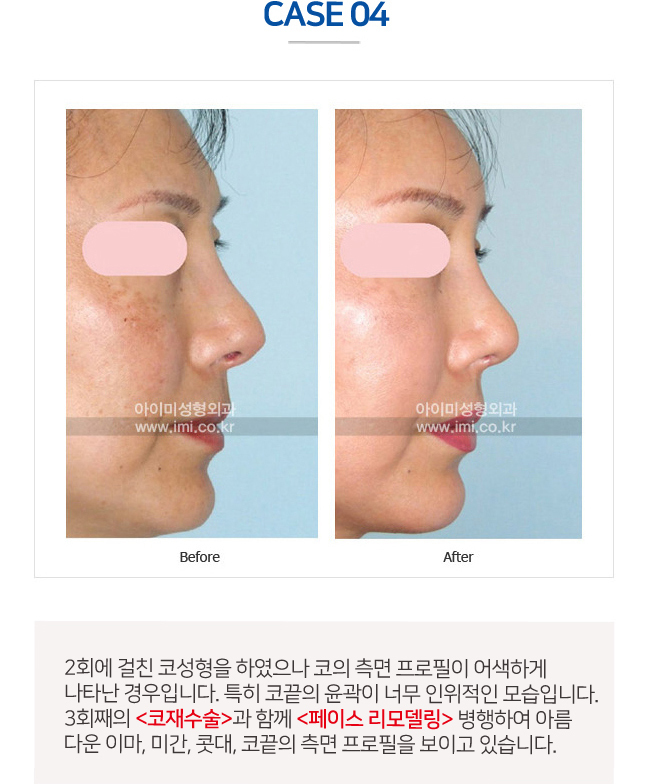 이미지명