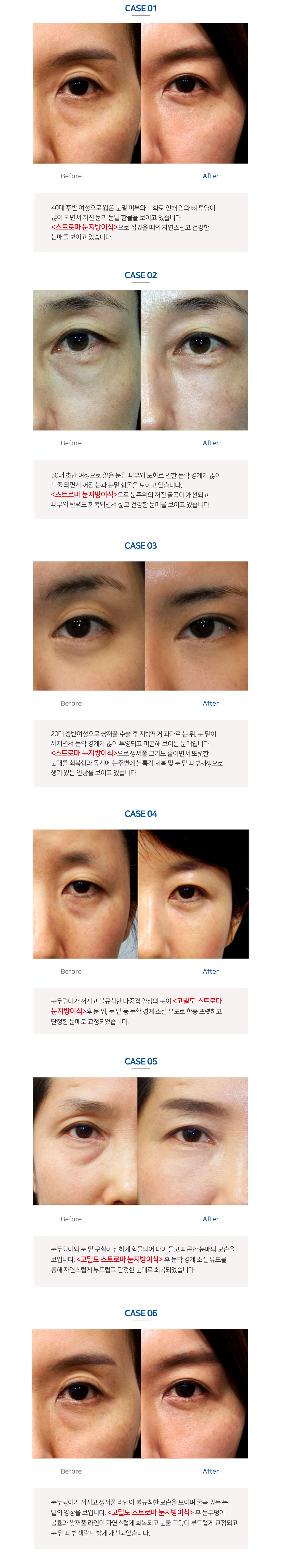 이미지명