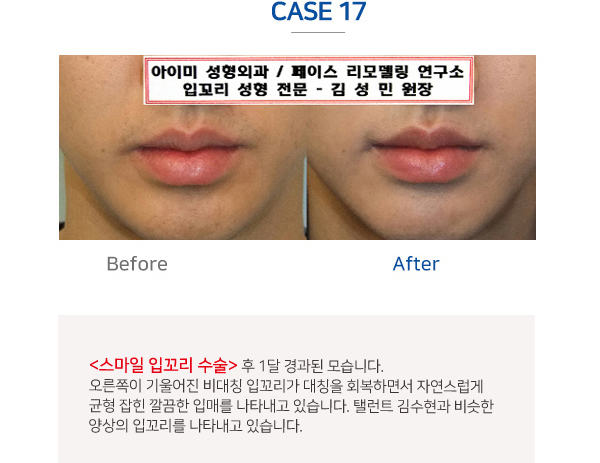 이미지명