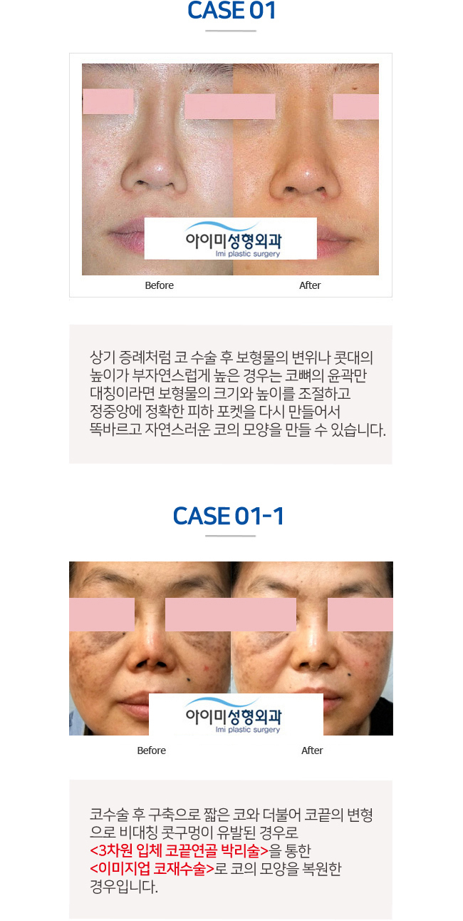 이미지명