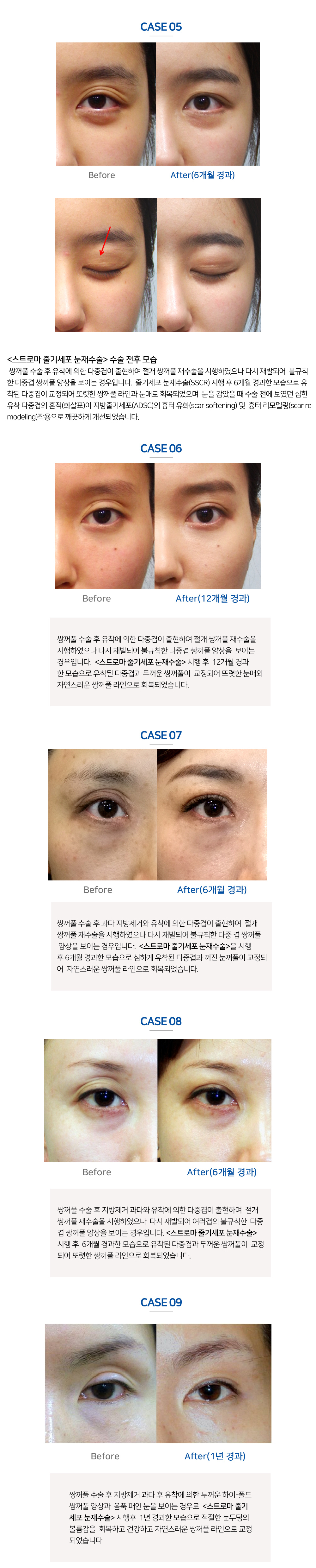 이미지명