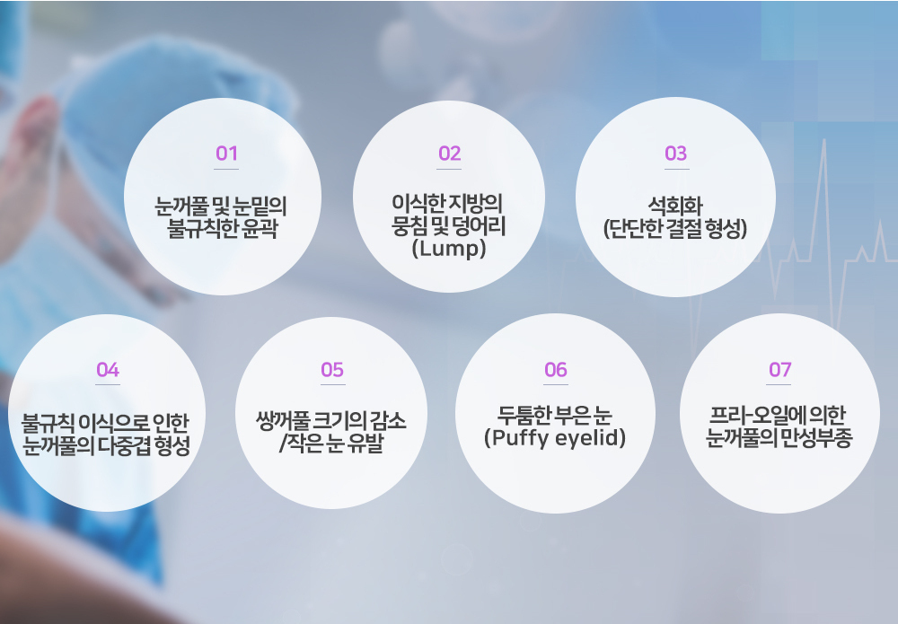 이미지명