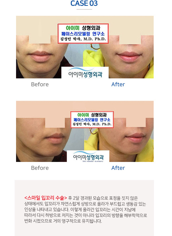 이미지명