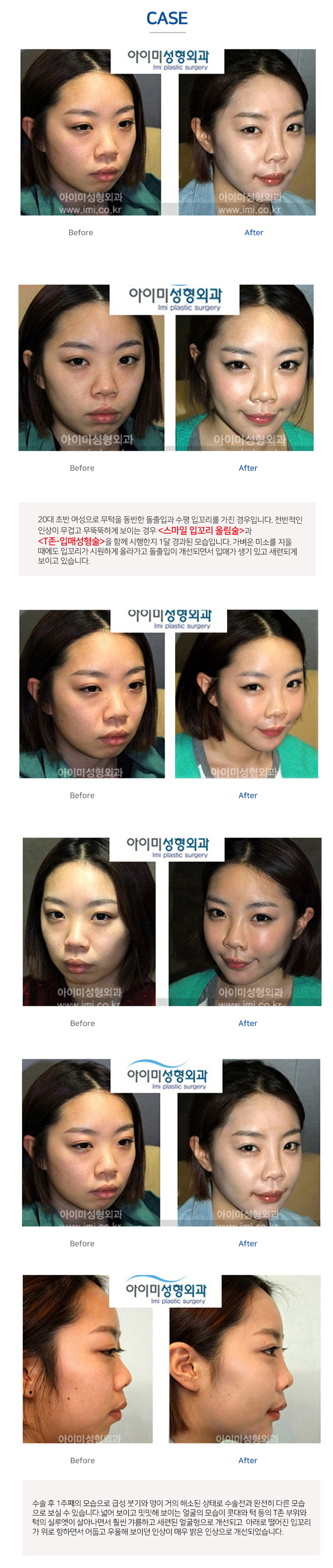 이미지명