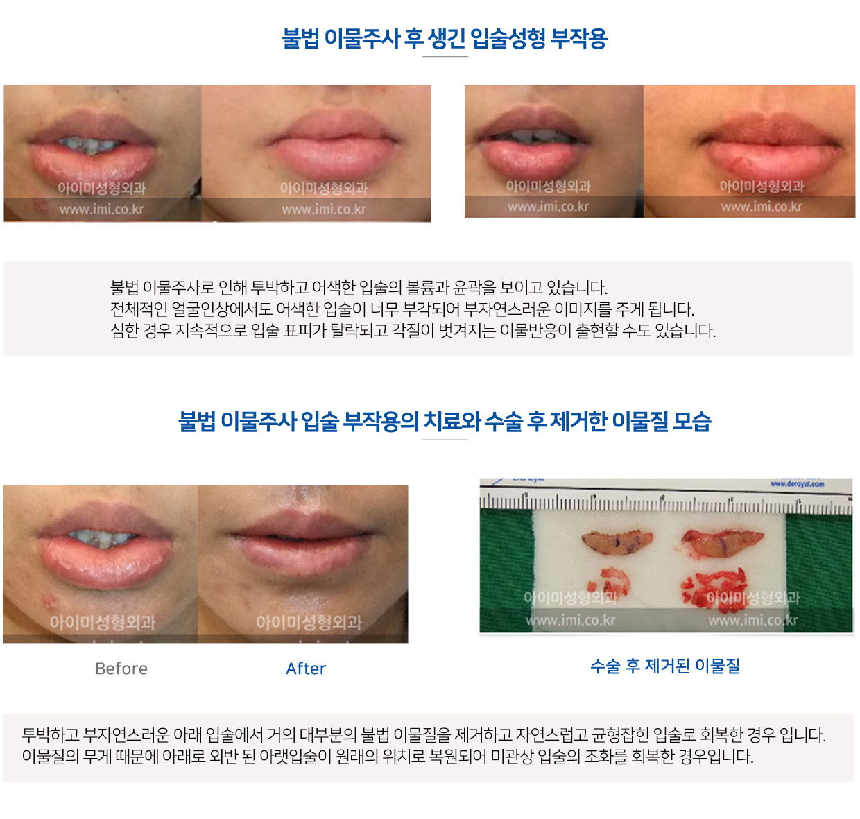 이미지명