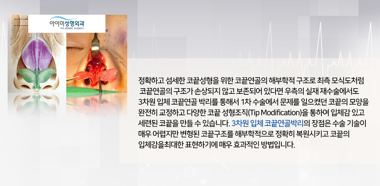 이미지명