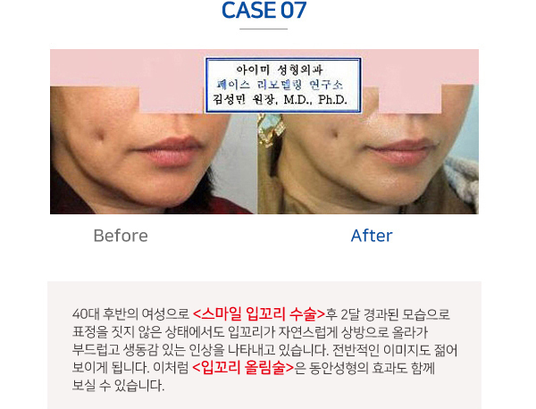 이미지명