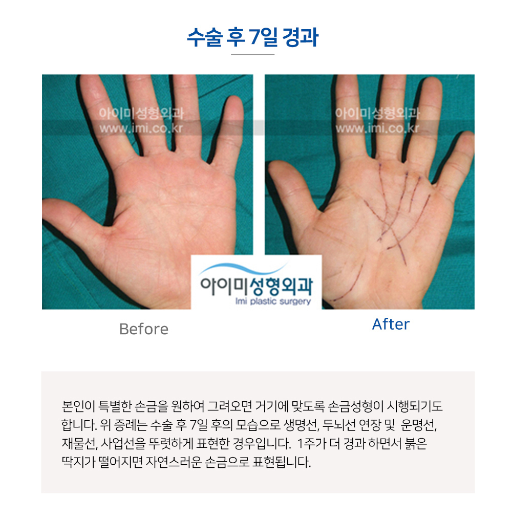 이미지명