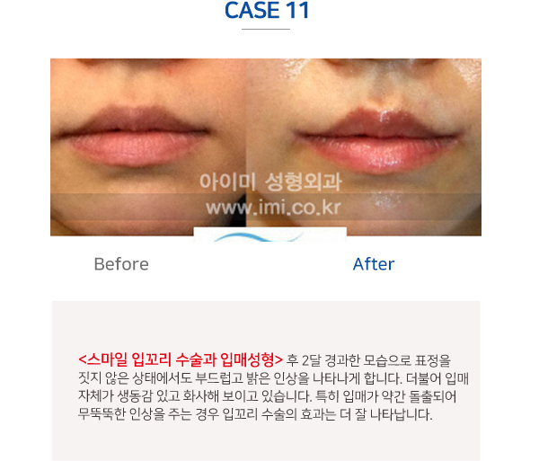 이미지명