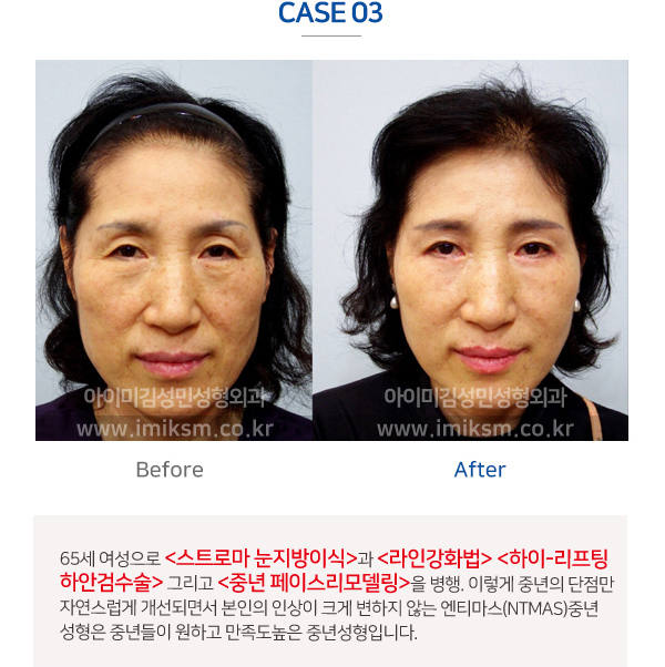 이미지명