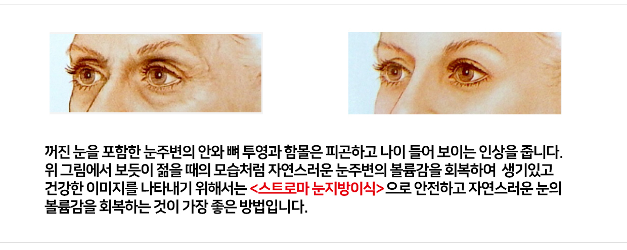 이미지명