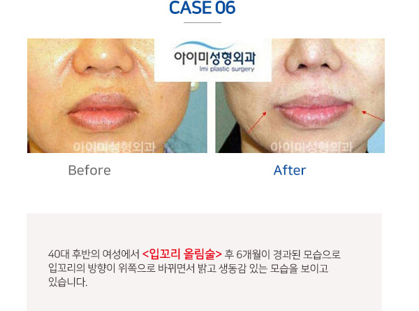 이미지명