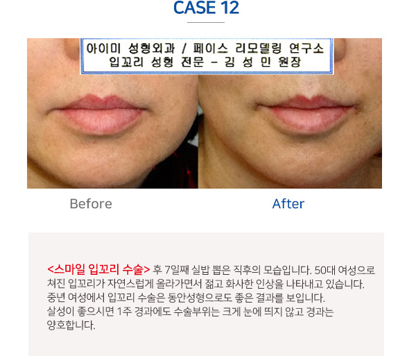 이미지명