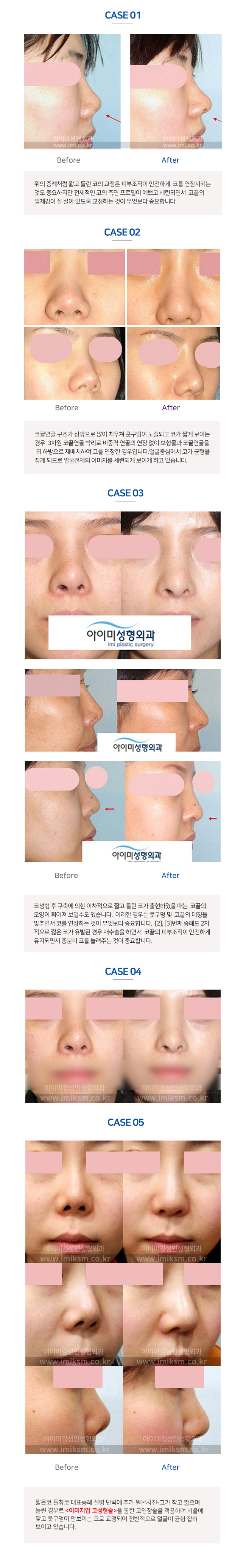 이미지명