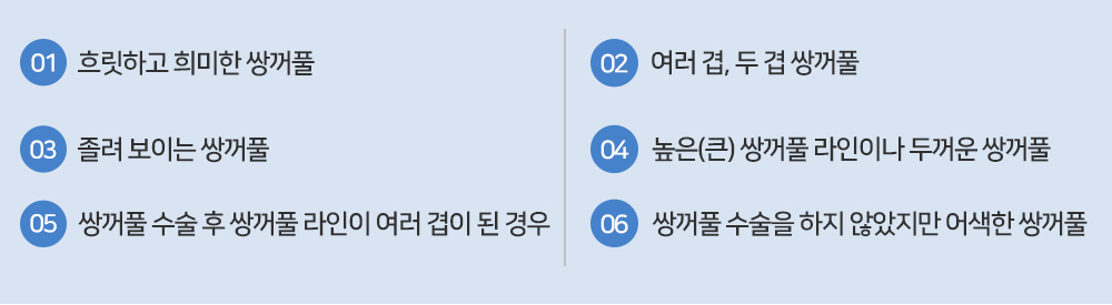 이미지명