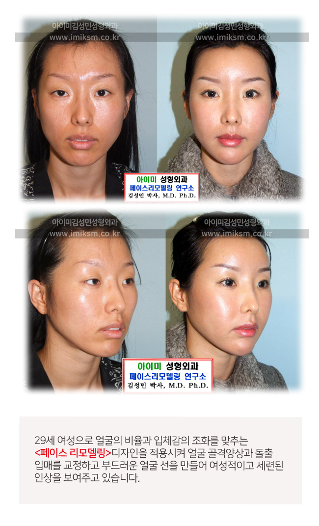 이미지명