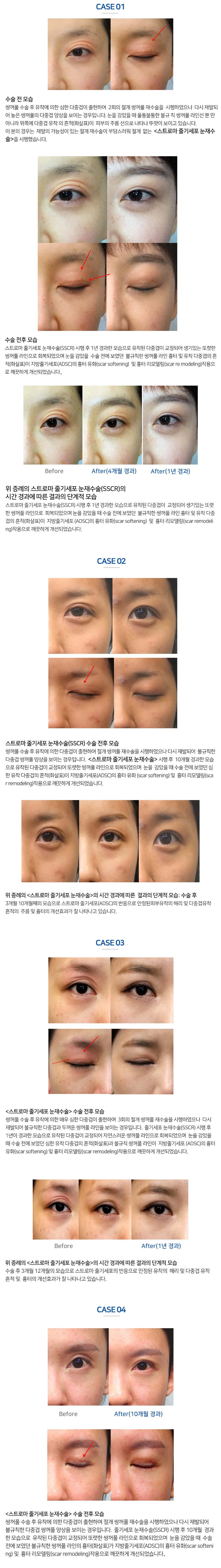 이미지명