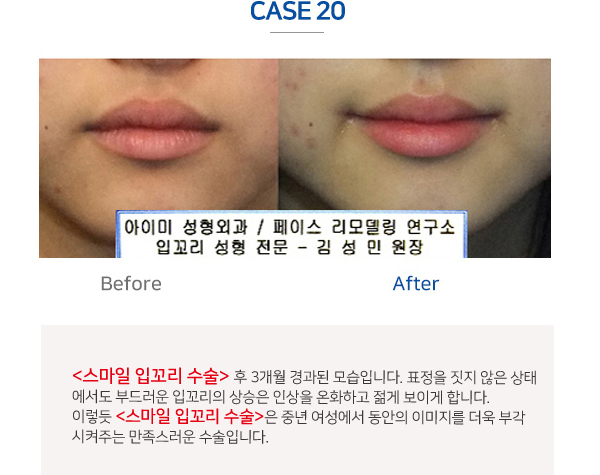 이미지명