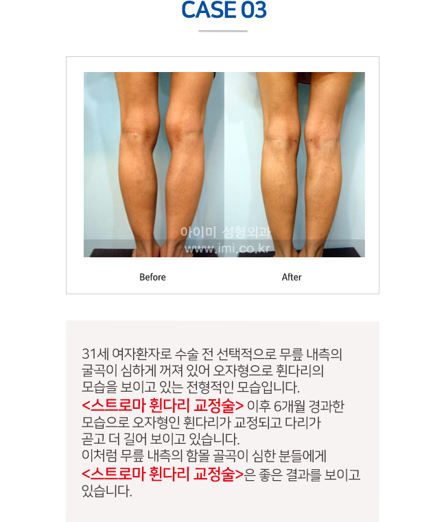 이미지명