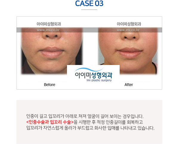 이미지명
