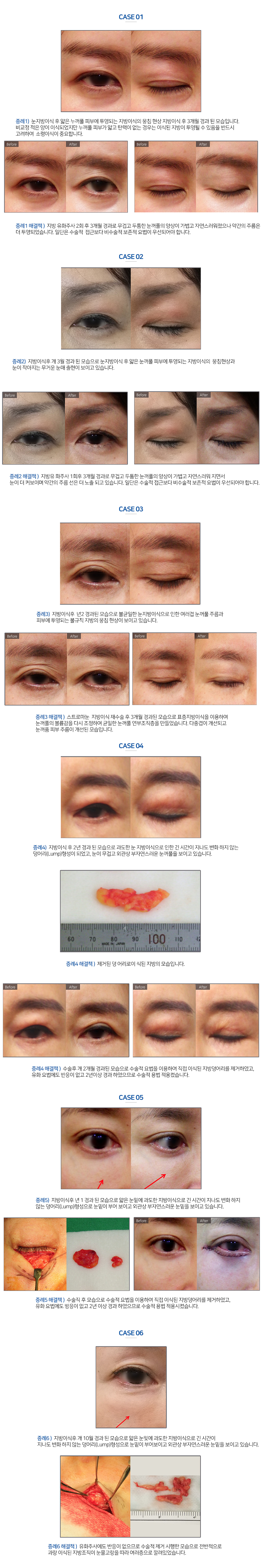 이미지명