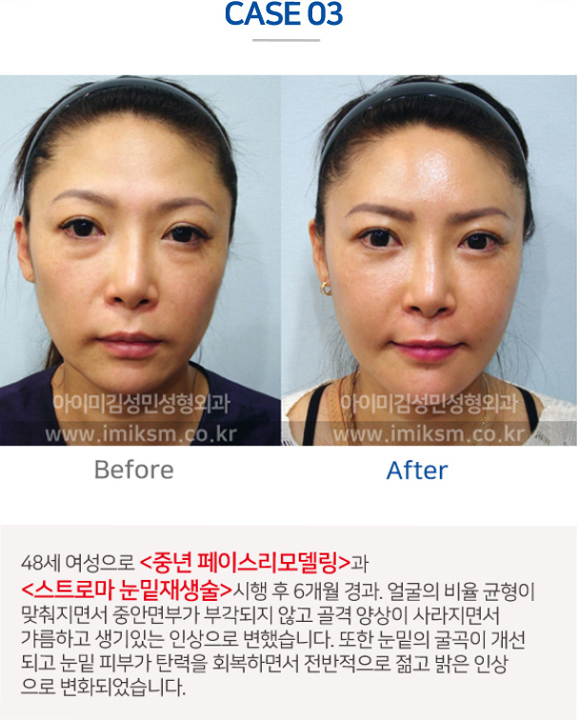 이미지명