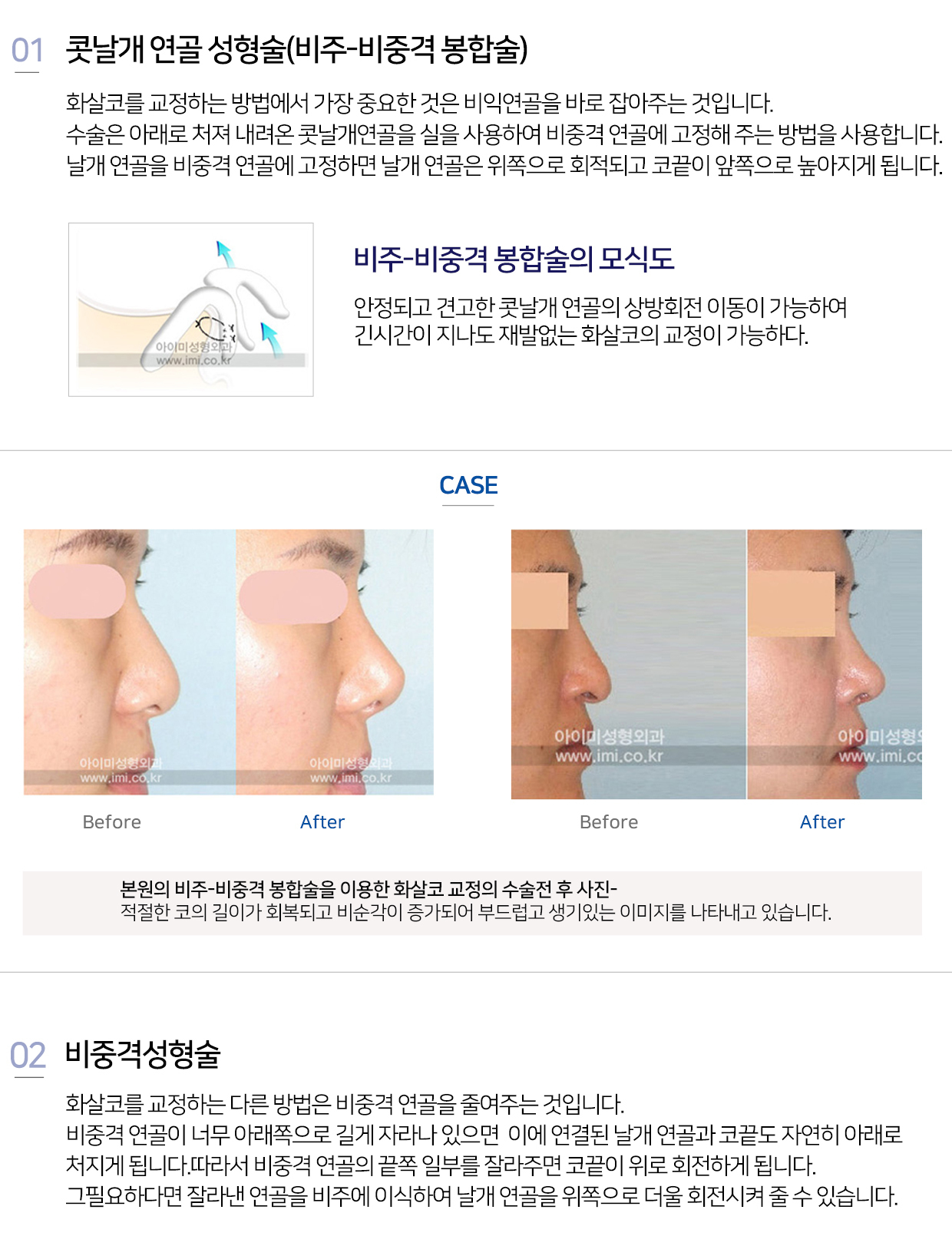 이미지명