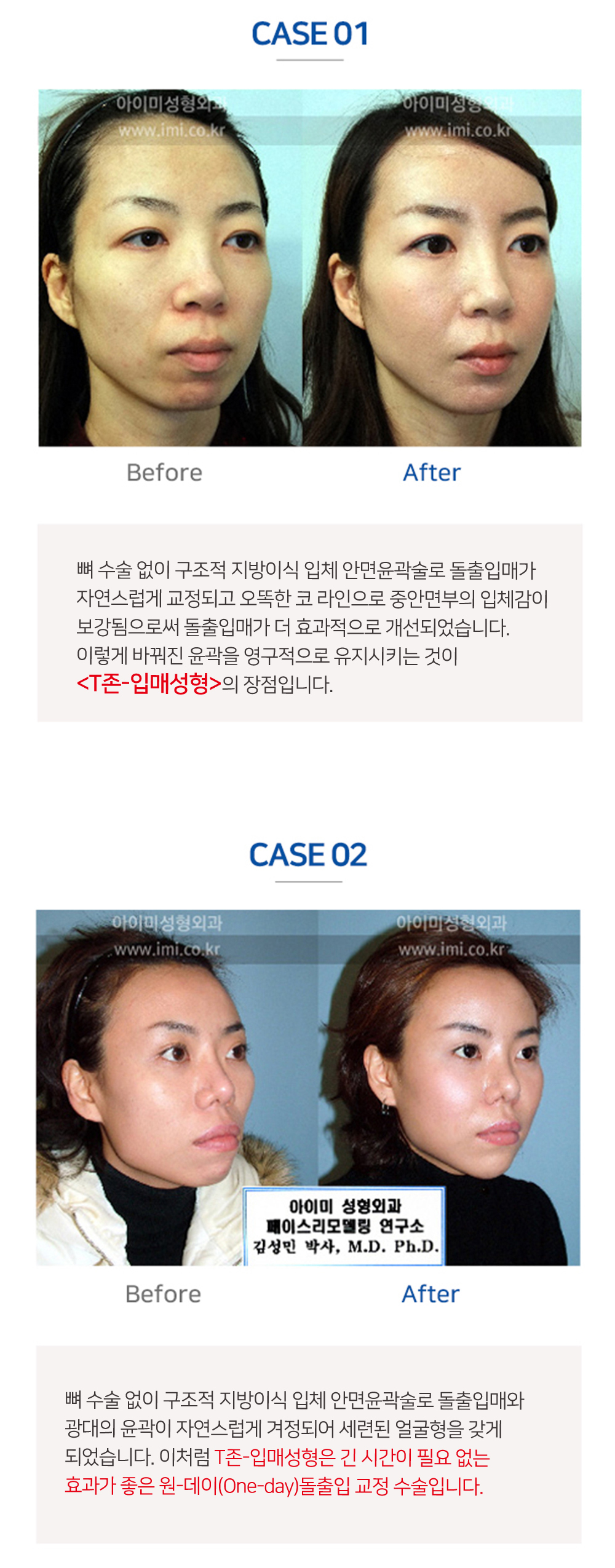 이미지명
