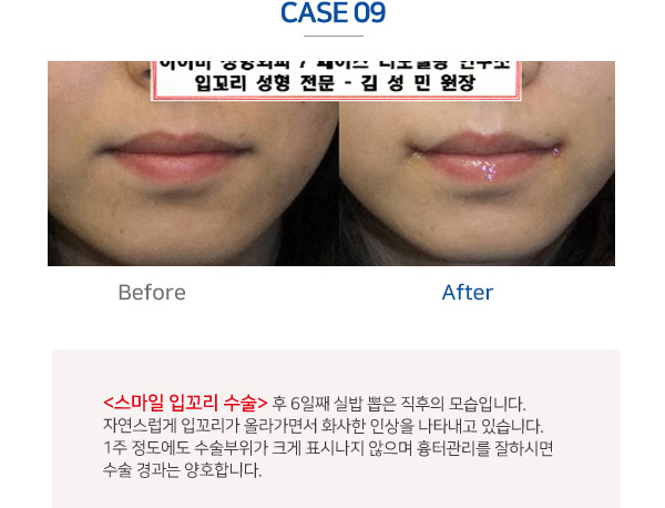 이미지명